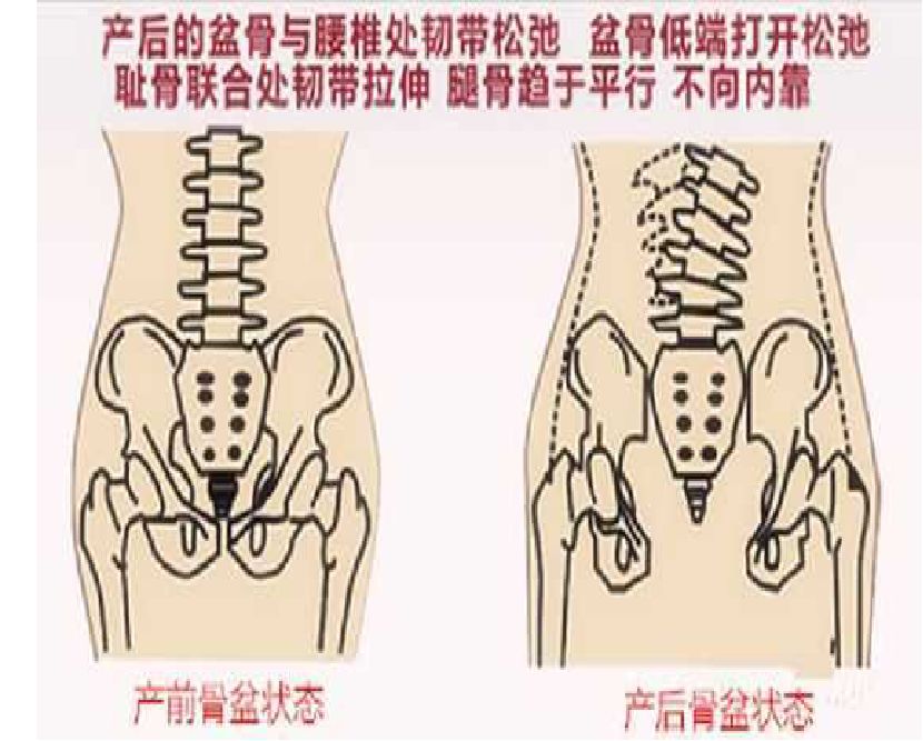 美容項目的另一桶金--產(chǎn)后康復師