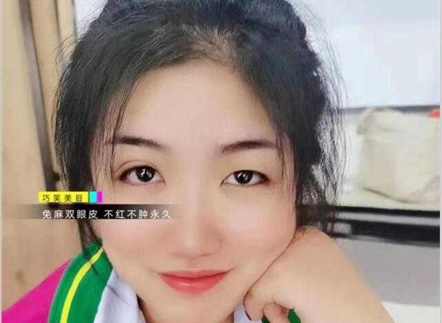 麗竹學(xué)?！凹y繡+雙眼皮”課程開講