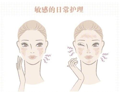 敏感肌保養(yǎng)大全！