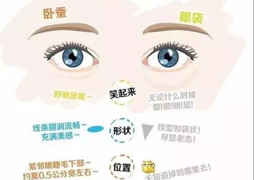 眼袋還是臥蠶，快來學(xué)辨別的方法