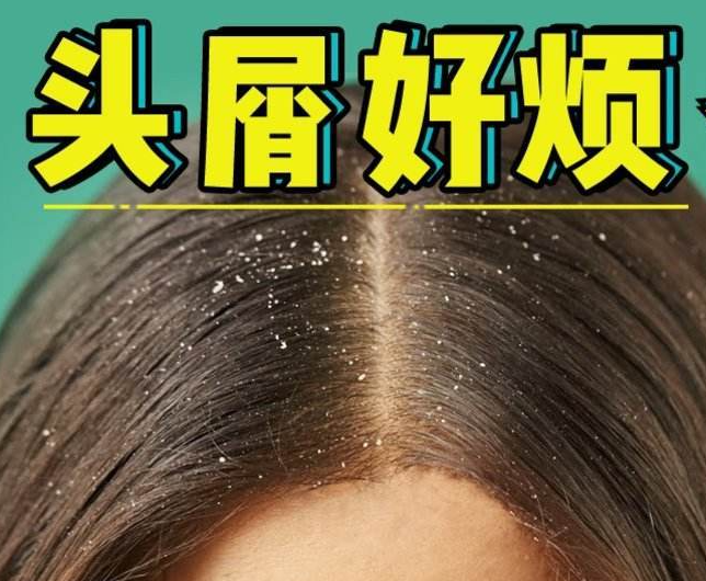 南寧正規(guī)美發(fā)培訓(xùn)學(xué)校分享：冬天如何減少頭屑過(guò)多？