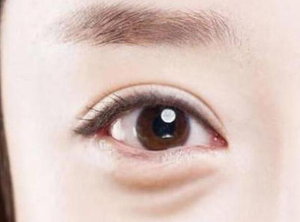 眼袋？淚溝？臥蠶？南寧美容學(xué)校教你辨別
