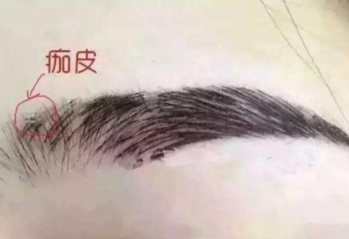 紋眉結(jié)痂時(shí)要注意什么？麗紋竹繡學(xué)校教你