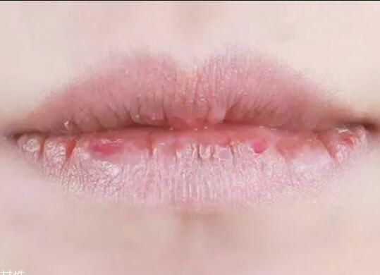 紋唇后嘴巴干燥怎么辦？南寧教紋繡的學校幫你解決
