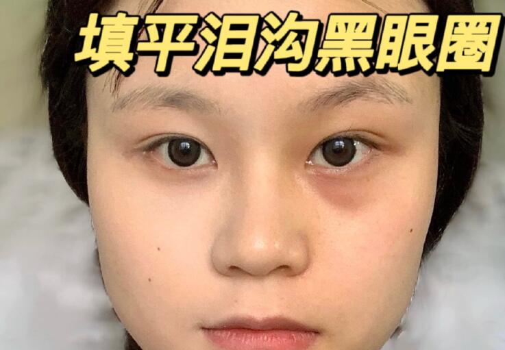 填平淚溝黑眼圈教程，廣西南寧化妝學(xué)校分享