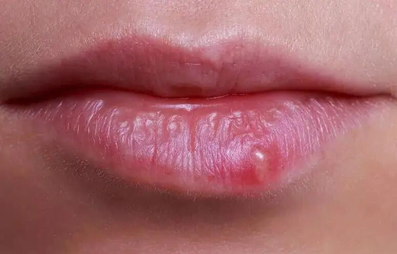 紋唇后起泡怎么辦？南寧紋唇培訓(xùn)學(xué)校教你方法