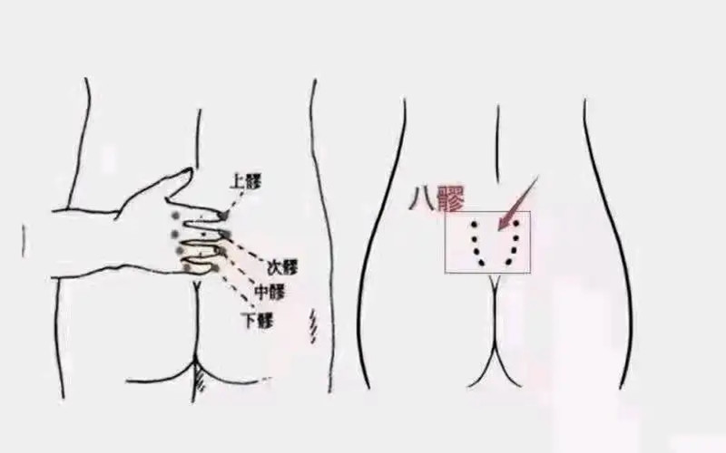 疏通八髎注意事項(xiàng)，南寧中醫(yī)美容學(xué)校培訓(xùn)內(nèi)容