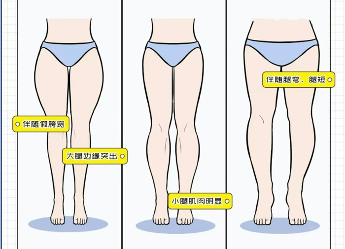 腿粗女生穿搭攻略，廣西彩妝造型搭配