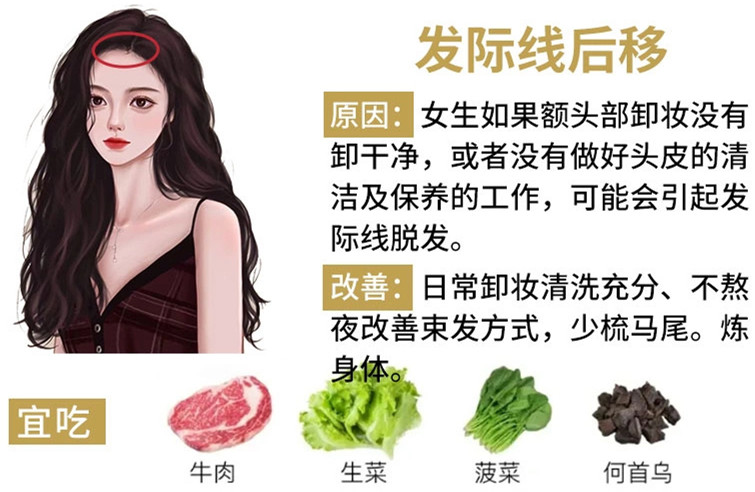 如何改善掉頭發(fā)？南寧頭療養(yǎng)發(fā)護(hù)發(fā)教學(xué)
