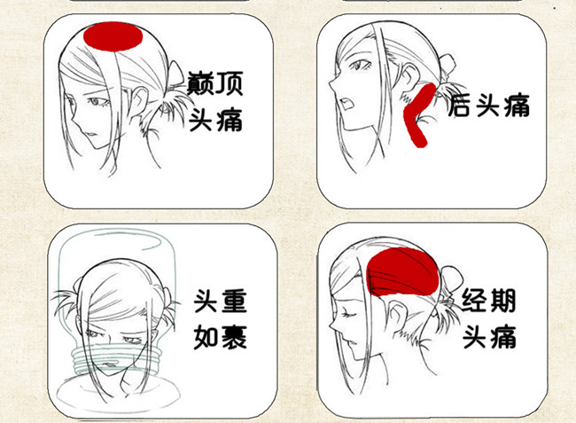 不同頭痛類型經(jīng)絡(luò)護(hù)理方法，廣西中醫(yī)美容培訓(xùn)